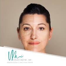 Dra. Vélez Maymi, Endocrinóloga