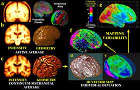 Surface, midbrain, side, side, ventricles, ventricles, ventricles, subarachnoid space, venous sinus, basal ganglia, brainstem, brainstem, anatomy structures, motor strip, animated atlas. Probabilistic Modeling Of Brain Anatomy Direct Averaging Of Imaging Download Scientific Diagram