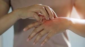 Поймать за руку, когда делал плохое. 12 Skin Conditions You Should Know About Everyday Health