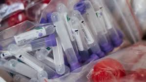 New Research Identifies Those Most At Risk From Long Covid