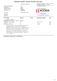 How is a blood test normally done? Vitamin D Blood Test Results Vitaminwalls