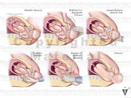 Image result for Shoulder Presentation