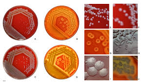 In blood cultures was evaluated by two methods. Colonial Morphology Wikipedia