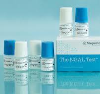 The NGAL Test Control Kit - Bioporto