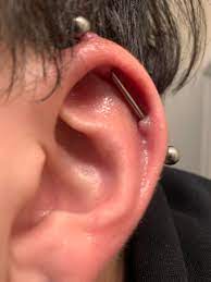Need Help With Industrial Piercing Bumps Piercingadvice