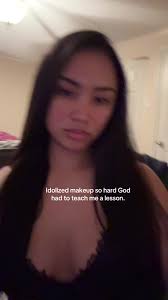 God Nerfed Me with Acne