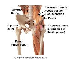 Groin pain might occur immediately after an injury, or pain might come on gradually over a period of weeks or even months. Hip Flexor Pain Or Iliopsoas Related Groin Pain