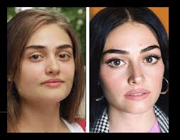 Eski fotoğraflarının ortaya çıkmasının ardından estetik yaptığı iddia edilen esra bilgiç, konu hakkında bir açıklama yaptı. Esra Bilgic Estetiksiz Hali Yatak Dekorasyonu