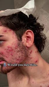 A beautiful skin requires commitment, not a miracle.