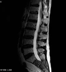 Technical requirements and clinical indications for the use of multiparametric mr imaging in detection, localization, characterization, staging, biopsy guidance, and active surveillance of prostate cancer are discussed. Prostate Cancer Radiology Reference Article Radiopaedia Org