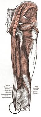 A tendon or sinew is a tough band of fibrous connective tissue that connects muscle to bone and is capable of. Pes Anserinus Tendon Diagram Radiology Case Radiopaedia Org