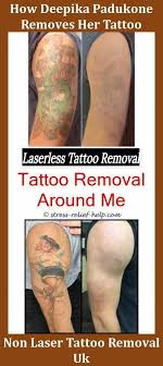 Tattoo removal training available now in the uk by industry expert, candice watson. Best Tattoo Removal Laser Near Me