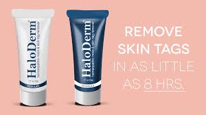 Which 10 Mole Removal Creams Are Best?
