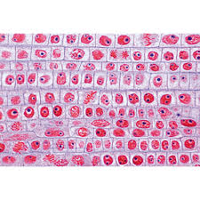 It prevents the slide from drying out when it's being. Plant Cell English Slides 1003982 W13053 Lieder 5100 En English 3b Scientific