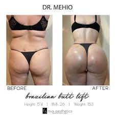 Complete with ambient background visuals, a pomodoro timer to stay focused. Mia Aesthetics This Transformation Bbl By Dr Mehio Facebook