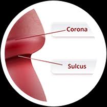 How to get rid of papules. 3p Gel What Causes Pearly Penile Papules 3p Gel