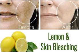 How To Lighten Dark Spots From Your Skin With Lemon Juice Lemon Is A Natural Bleaching Agent And Because Of Its Na Lighten Dark Spots Lemon Skin Skin Bleaching