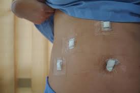 Most Painful Surgeries And How To Prepare For The Recovery