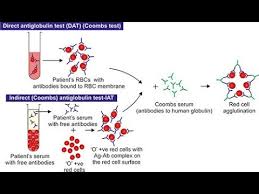 Image result for Indirect Coombs