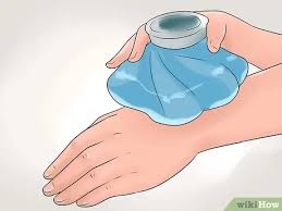 كيفية علاج الحروق صور توضيحية wikihow