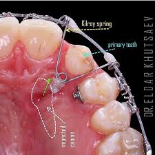 Dental Assistant Jobs Near Me 2020 Dental Assistant Dental Orthodontics