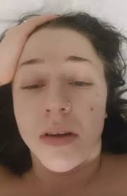 Rusavhengighet: Sunniva Sabine Gule Hellwig forteller om livet som ung  kvinne med rusproblemer