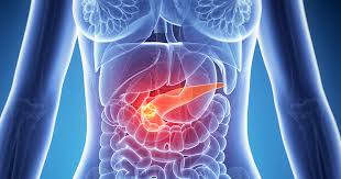 It can also be very useful because it raises your alertness. What To Do If Pancreatic Mass Is Detected Bangkok Hospital