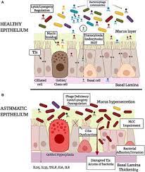 An animal cell encounters a new type of bacterium. Frontiers Interactions Of Bacteriophages And Bacteria At The Airway Mucosa New Insights Into The Pathophysiology Of Asthma Allergy