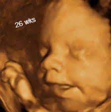 Pin On 3d Ultrasound 4d Ultrasound Gender Determination