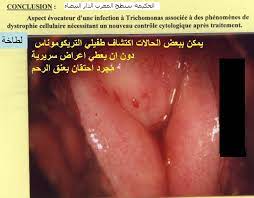 في الوقت المناسب فحم غير ملائم صور الفرج عند النساء dsvdedommel com
