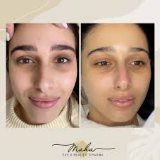 מהא טיפולי יופי וקוסמטיקה