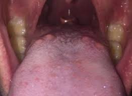 Maybe you would like to learn more about one of these? Addisu Alemneh Addisualemneh Profile Pinterest