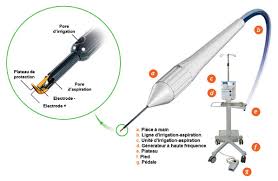 Rapport Sfo 2014 Glaucome Primitif A Angle Ouvert