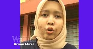 Untuk lebih mengetahui tentang penyakit ginjal, kitabisa mengadakan tanya jawab dengan dr. Bahaya Sle Saya Anggap Diri Sihat Tak Berpenyakit Arumi Mirza Mingguan Wanita