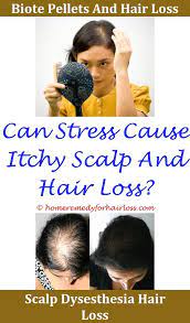 Causes Of Sudden Hair Thinning Hair Loss Control Hair Loss Men Hair Loss Reasons