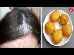 It is similarly a remedy for premature gray hair. Say Goodbye To Grey Hair Only With This Simple Ingredient You Usually Throw Away Youtu Grey Hair Natural Remedy Hair Care Remedies Cover Gray Hair Naturally