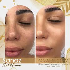 ساناز ساختمان|sanaz sakhteman‎ (@sanazsakhteman.skincare) • Instagram  photos and videos