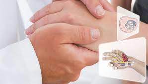 Karpaltunnelsyndrom Behandlung Arzte Informationen Medspecialists