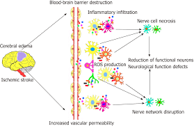 Neural Stem Cell Transplantation Therapy For Brain Ischemic