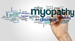 Image result for Myopathy