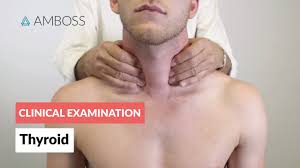 Jaundice due to liver problem (also see my other post about early signs of liver damage), sinus infection, a problem with the thyroid gland, lung infection and lymphedema (fluid retention that generally occurs. Examination Of The Thyroid Clinical Examination Youtube