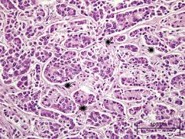 Some dogs have signs that. Pancreatic Tumor An Overview Sciencedirect Topics
