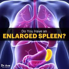 Below, we discuss 10 possible causes of upper left abdominal pain under the ribs and explain when a person with this. Enlarged Spleen Symptoms Warning Signs 5 Treatments Dr Axe