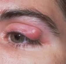 Image result for Blepharis bainesii