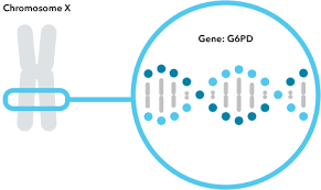 Image result for G6PD Deficiency