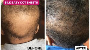 Some baby's hair grows back though some baby comes without hair. How To Grow Back Babies Hair Fast In 2 4 Weeks Youtube