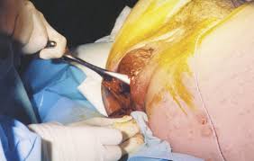 Forceps Delivery | Homeopathic | Best Homeopathic Doctor in Pakistan | Dr Qaisar Ahmed MD, DHMS