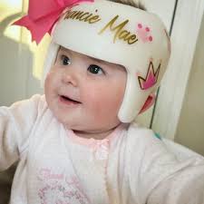 Baby Helmet Cranial Band Decals, Fixing My Crown and Dot Princess  Plagiocephaly Docband Decals, Baby Girl Cranial Helmet Design Stickers
