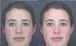 Red in the Face: People use your skin colour to judge how healthy you are