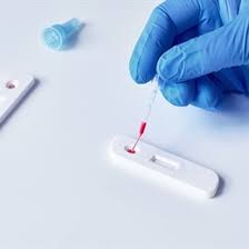 Pcr (polymerase chain reaction), dna içerisinde yer alan, dizisi bilinen iki segment arasındaki özgün bir bölgeyi enzimatik olarak çoğaltmak için uygulanan tepkimelere verilen ortak bir isim olarak tanımlanmaktadır. Antikor Testi Nedir Ve Kimlere Yapilabilir Medicana Saglik Grubu